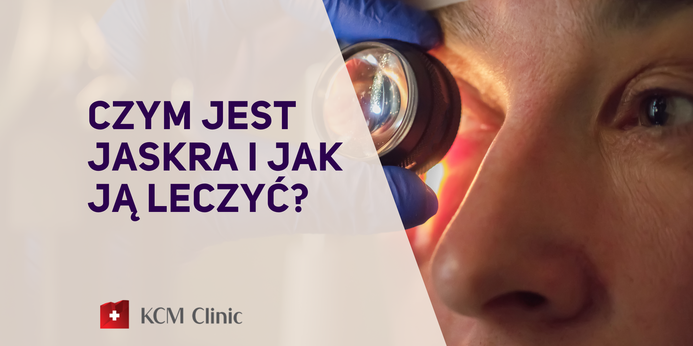 okulistyka jaskra operacja