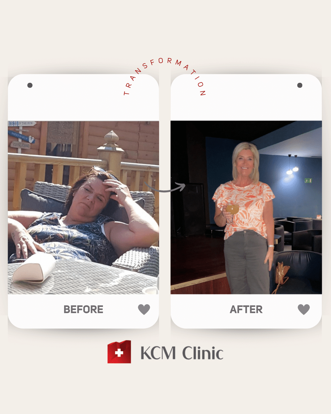 Bariatria otyłość zmniejszenie żołądka weight loss surgery