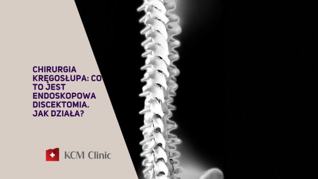 Endoskopowa discektomia