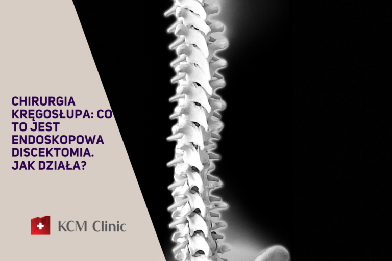 Endoskopowa discektomia
