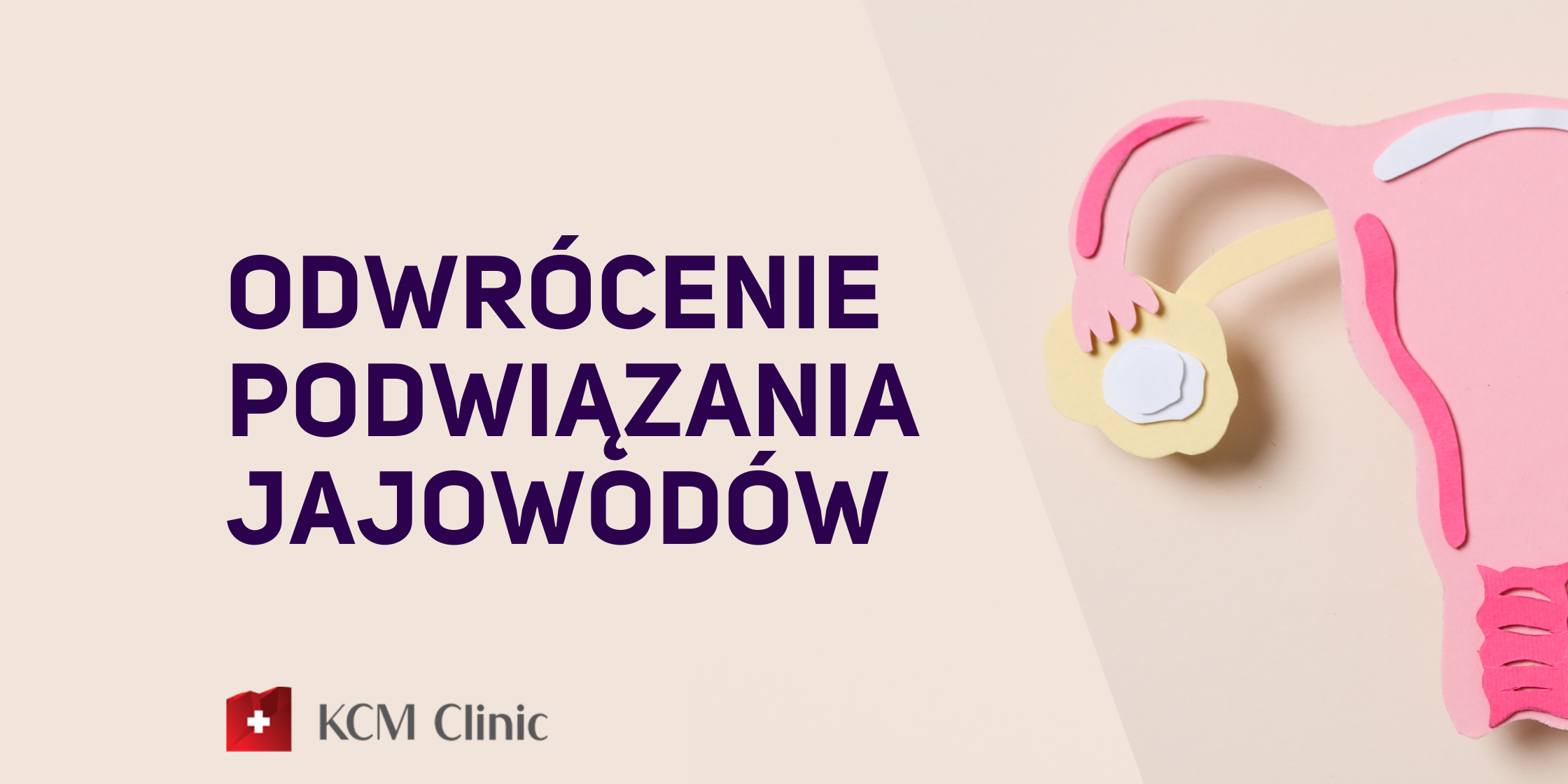 ginekologia odwrócenie podwiązania jajowodów kcm