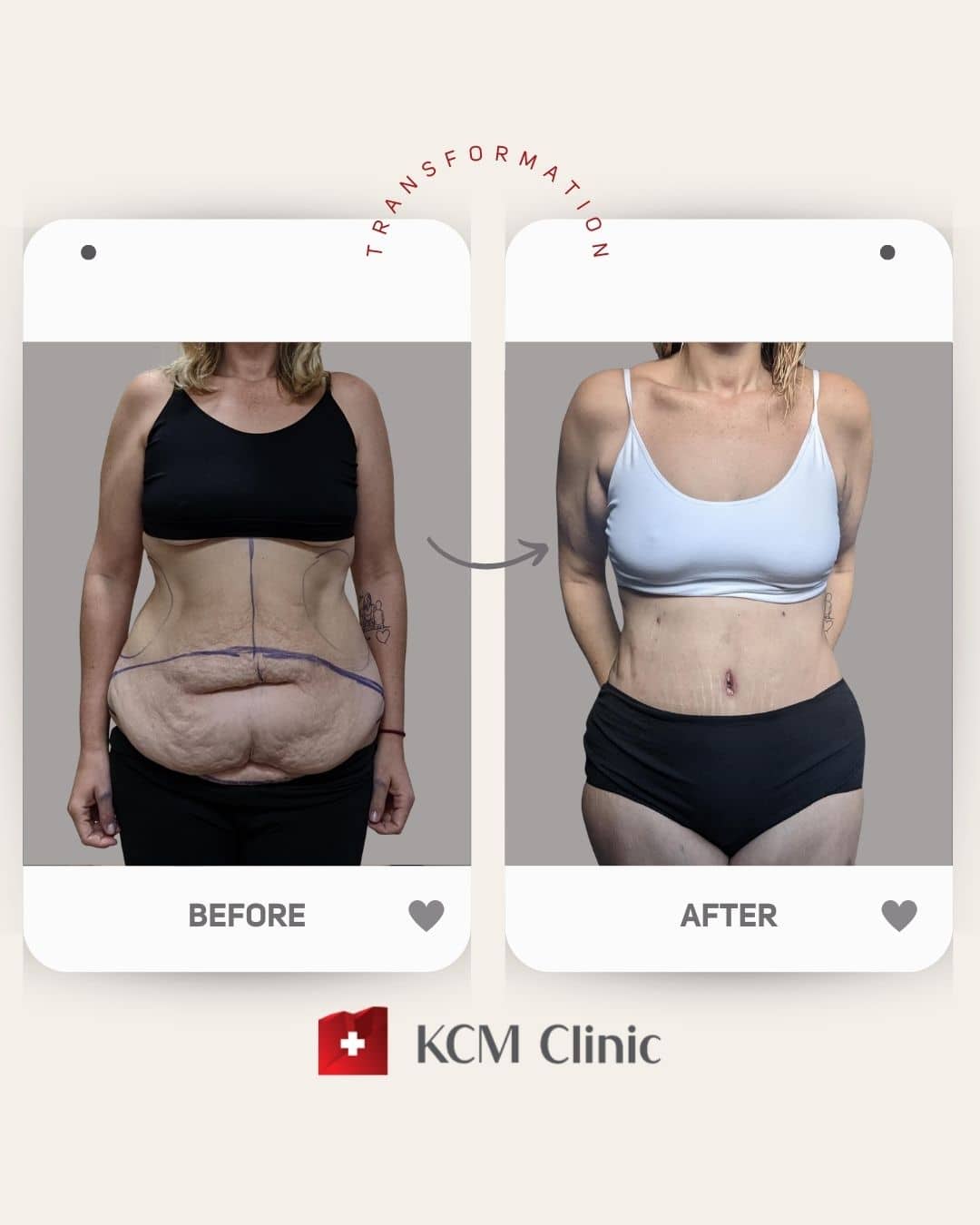 Operacja Plastyczna Plastic Surgery
