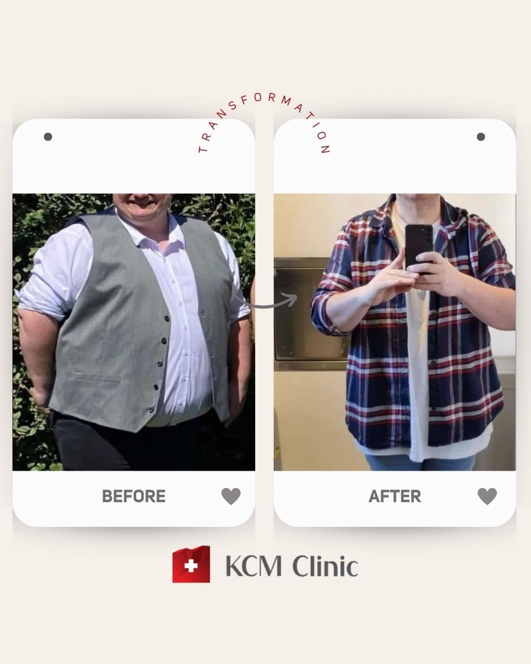 zmniejszenie żołądka weight loss surgery Bariatria otyłość