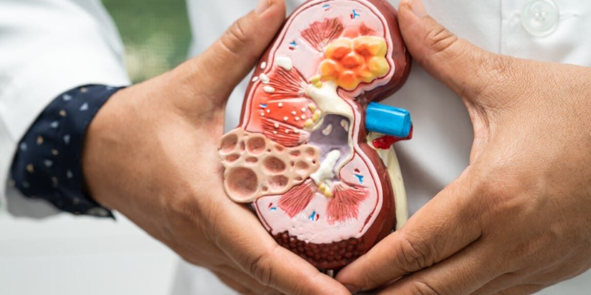 Kidney disease, Chronic kidney disease ckd, Doctor hold model to
