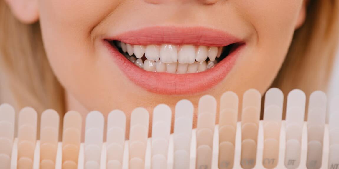 cropped view of smiling woman holding teeth color palette, teeth whitening concept